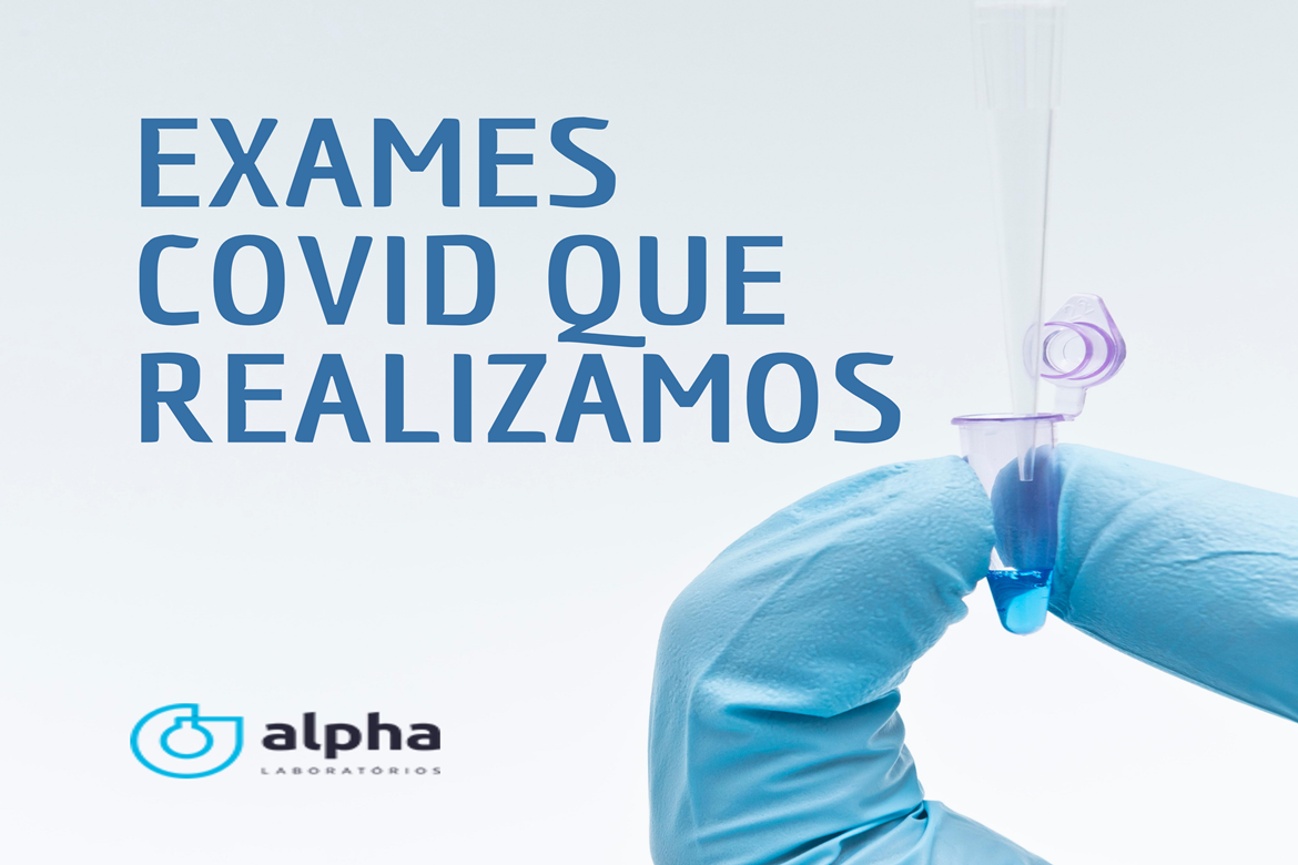 2020 08 19 FEED EXAMES COVID QUE REALIZAMOS APROVADO