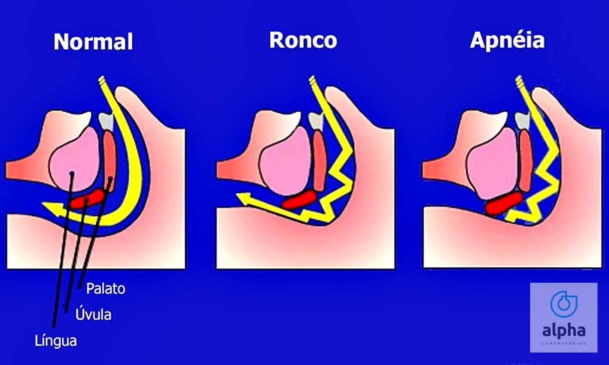 03 09 SEMANA 01 Apneia do sono imagem02