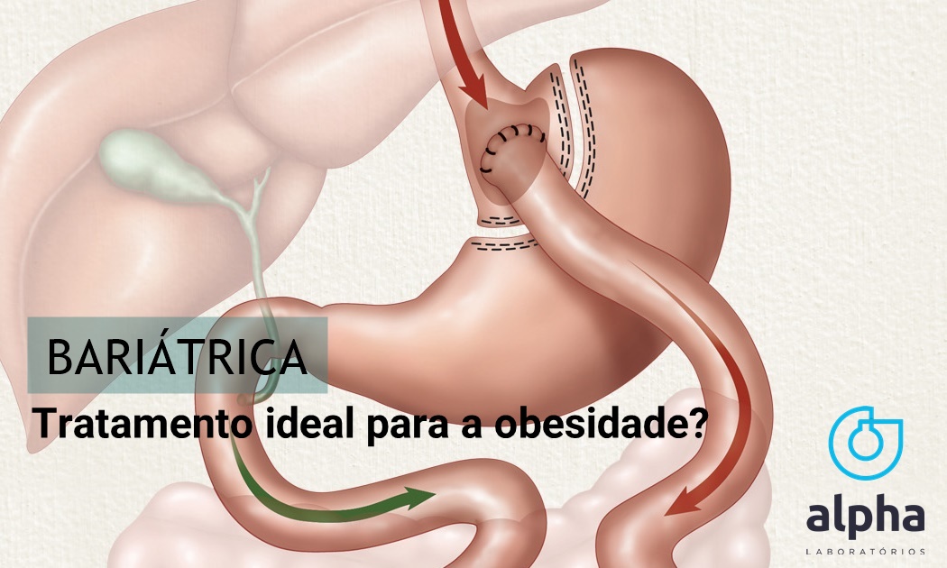 01 ALPHA SEMANA 05 06 BARIATRICA imagem