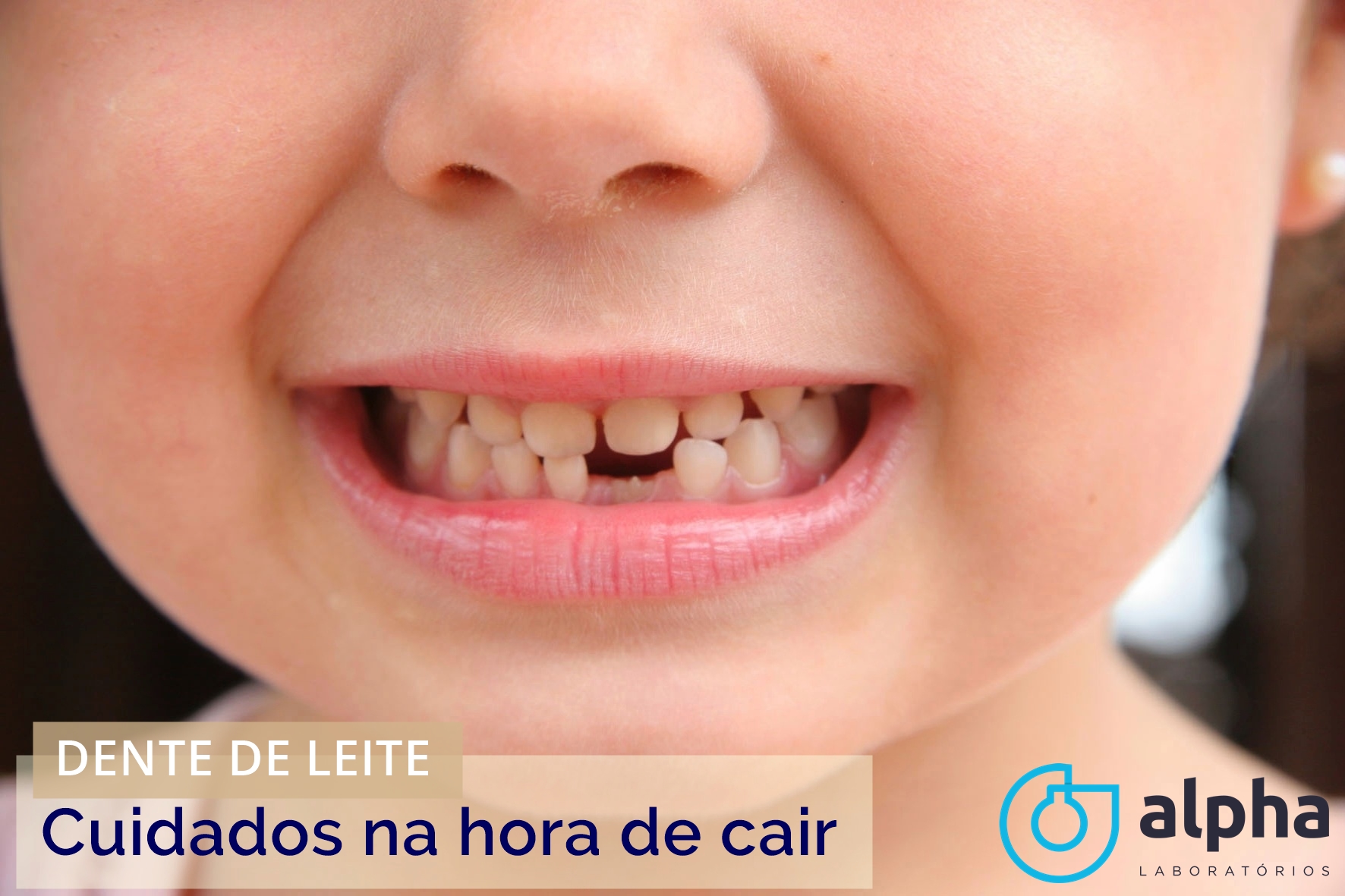 12 ALPHA SEMANA 01 04 DICAS DE COMO ARRANCAR O DENTE DE LEITE DO SEU FILHO IMAGEM