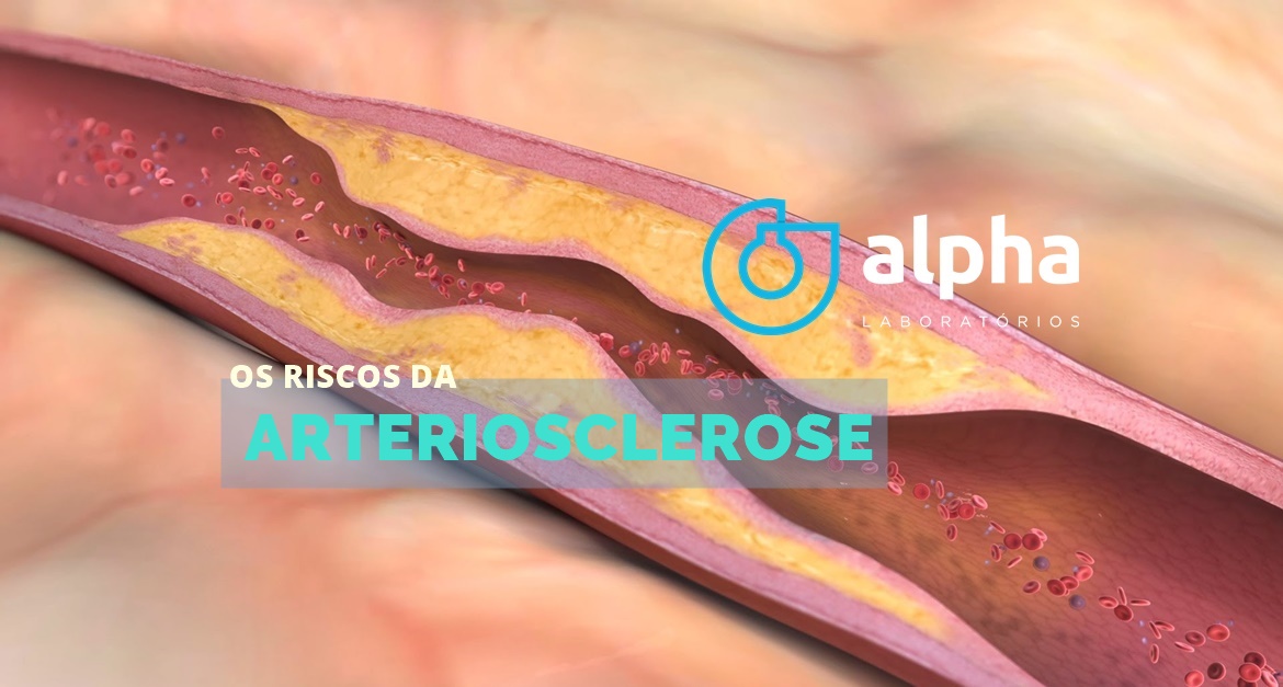 02 ALPHA SEMANA 02 05 ARTERIOSCLEROSE