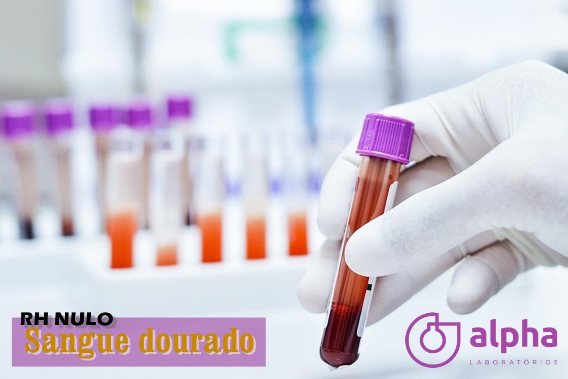 x12 RH nulo imagem site