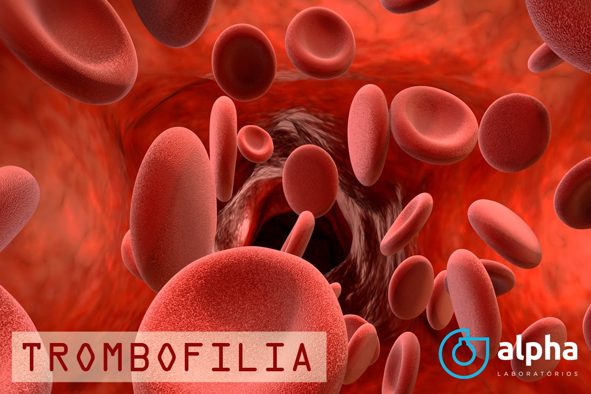 05 ALPHA SEMANA 01 02 TROMBOFILIA SITE2