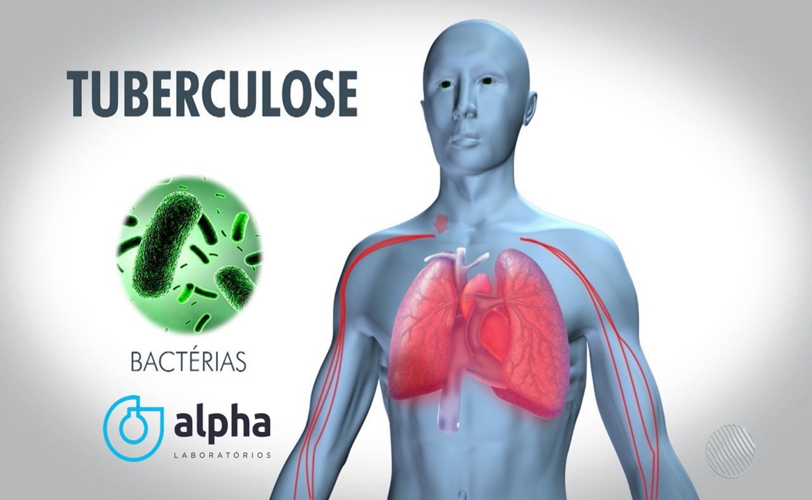 05 ALPHA SEMANA 02 02 TUBERCULOSE SITE