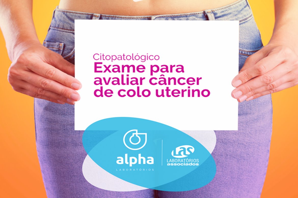 Alpha 09 10 Post CMP Câncer Colo Útero NOTICIA