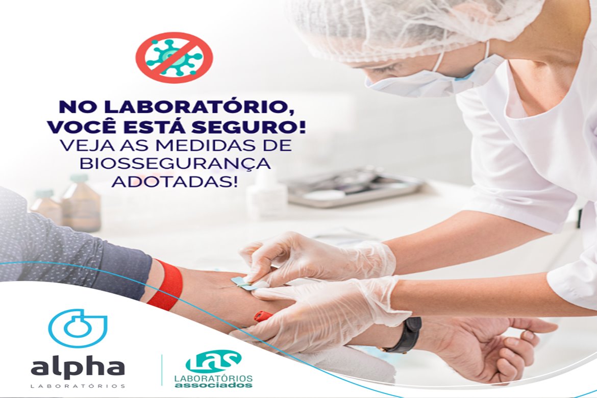 2 ALPHA POST LABORATÓRIO É SEGURO site